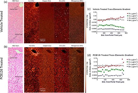 Trace Element Distribution Throughout The Liver Acinus And Its