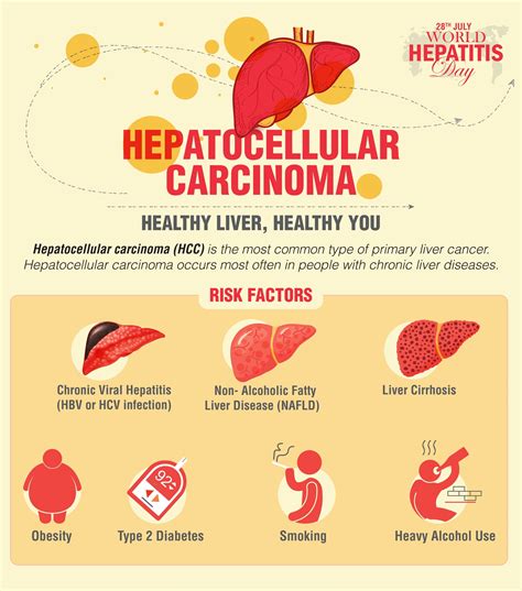 Top 93 Pictures Early Signs Of Liver Cancer In Females Latest