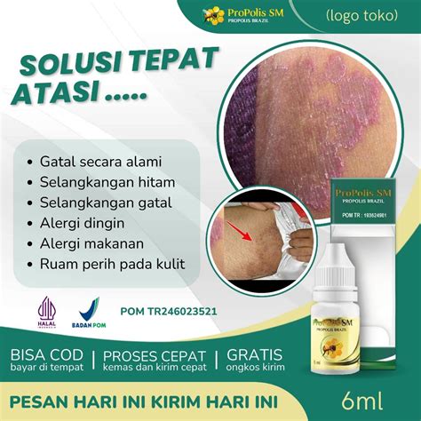 Jual Obat Selangkangan Gatal Obat Alergi Dingin Obat Alergi Makanan