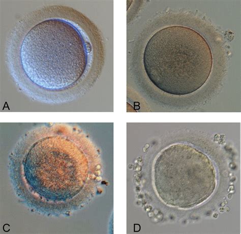 Four Types Of Oocytes Used In Human Scnt Experiments A Grade A