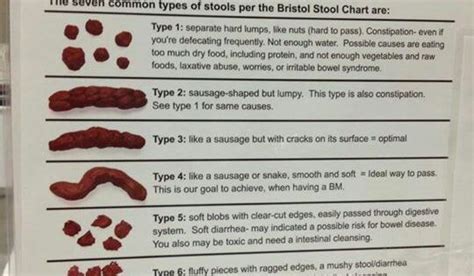 Colon Cancer Stool Color Chart