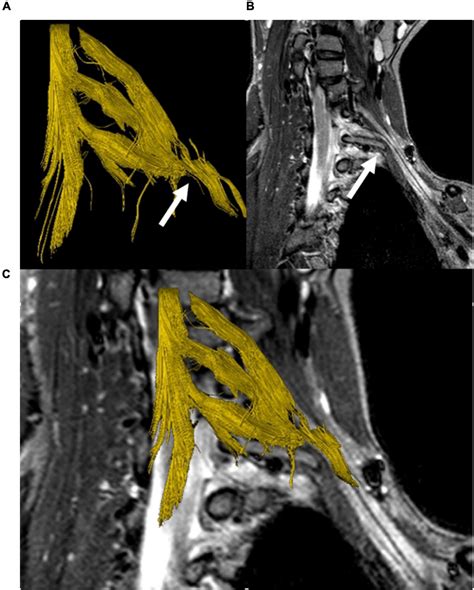 Frontiers High Resolution Ultrasound And Magnetic Resonance Imaging