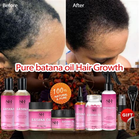 Pcs Honduras Batana Oil Hair Growth Set African Fast Hair Growth