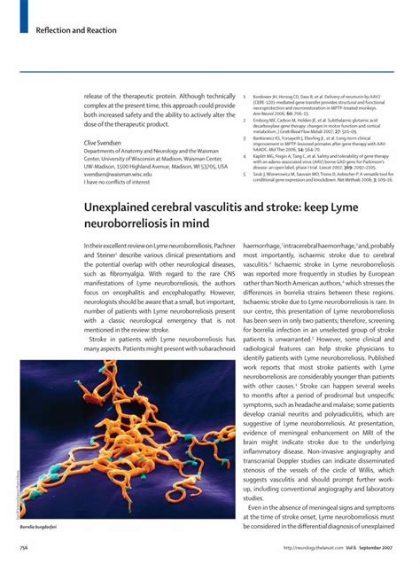 Pdf Unexplained Cerebral Vasculitis And Stroke Keep Lyme