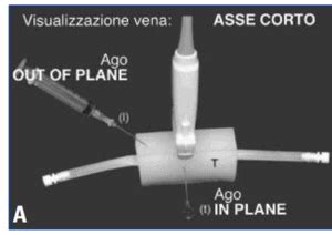 Limportanza Dellecografia Negli Accessi Vascolari Campus Vygon Italia