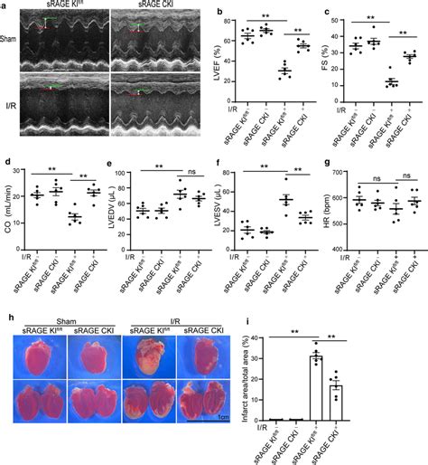 Srage Inhibited Cardiac Dysfunction And Reduced Infarct Area Induced By