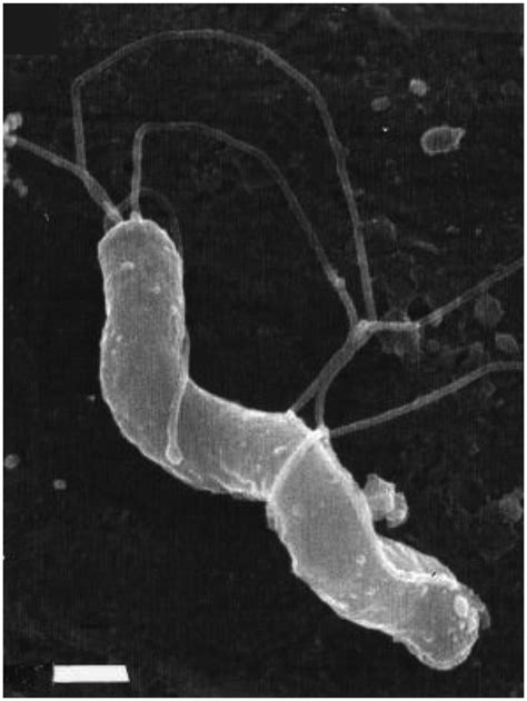 Helicobacter Pylori