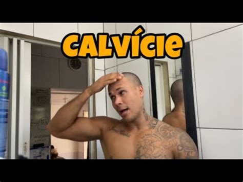 Estou FICANDO CALVO Careca E Agora YouTube