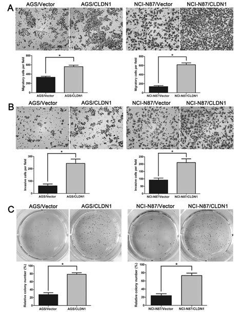 Overexpression Of Cldn1 In Gastric Cancer Cells Ags And Nci N87