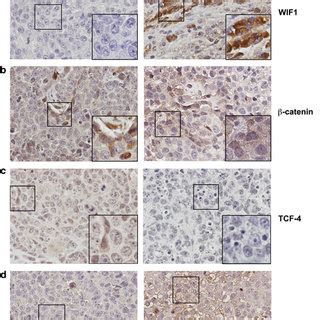 WIF1 Inhibits Tumor Growth And Invasion In Mouse Cervical Tumor