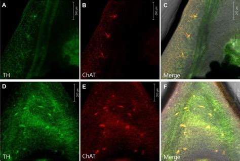 Confocal Immunofluorescent Micrographs Of Adult C Sinensis