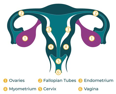 What Is Ovarian Cancer? – World Ovarian Cancer Coalition