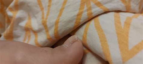 Is this what is called "clubbed nails"? : r/AskDocs