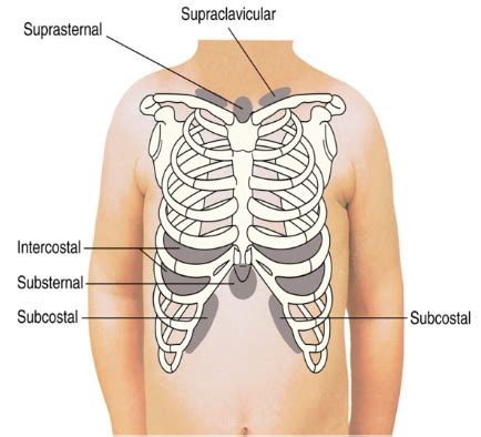 Peds Exam Sensory Respiratory Flashcards Quizlet