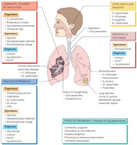 Respiratory Tract Infections Flashcards Quizlet