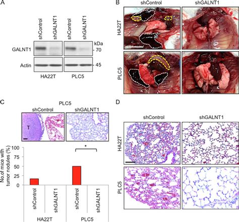 Knockdown Of Galnt Suppresses Hcc Cell Metastasis In Vivo A Stable