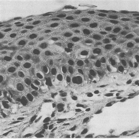 Stratified cuboidal epithelium composed of several layers of cuboidal ...