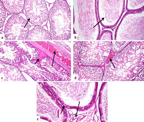 Photomicrograph Rat A Testes Of The Control Group Showing A Normal Download Scientific