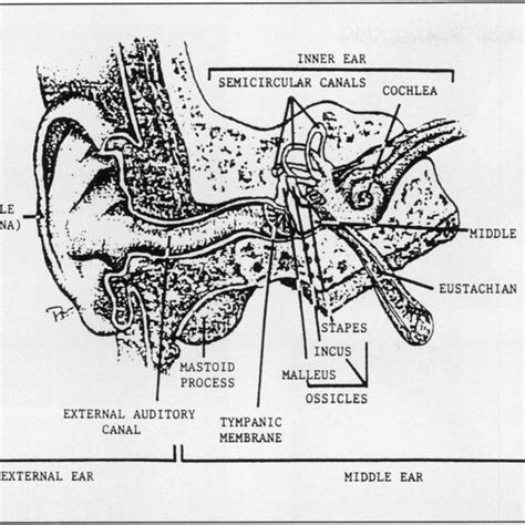 Presence Of Fluid And Air Bubbles Behind The Tympanic Membrane Download Scientific Diagram