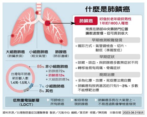 肺鱗癌晚期難救 醫界籲放寬免疫給付 生活新聞 生活 聯合新聞網