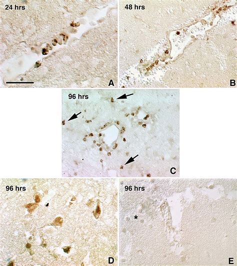 IRF 1 Immunoreactivity In The Postischemic Brain Of Mice Subjected To