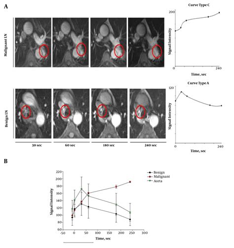 Dynamic Contrast Enhanced Dce Mri A Dce Mri Of Lns Axial View Of