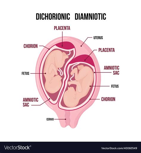 Anatomy Of Abdomen With Twins Pregnancy Type Vector Image