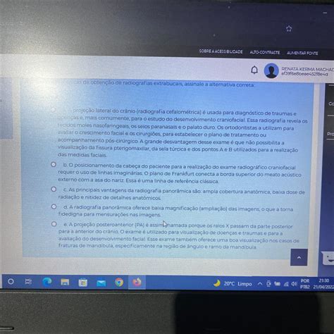 A Respeito Das Asserções Assinale A Opção Correta - A Respeito Das Asserções Assinale A Alternativa Correta - BRAINCP
