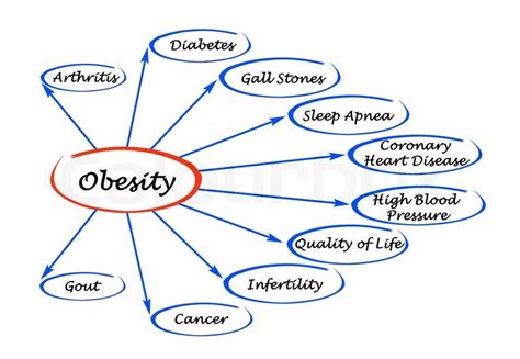 Diagram of Obesity | Stock image | Colourbox