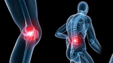 2 Tanda Peringatan Arthritis Yang Sebabkan Nyeri Sendi