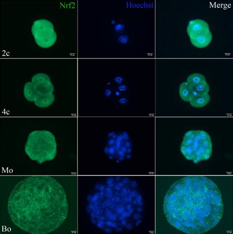 The Subcellular Localization Of Nrf2 During Mouse Embryo Development Download Scientific