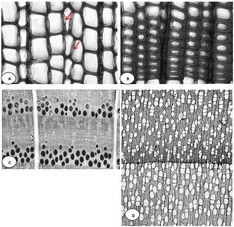 Microscopic Cross Sections Of Scots Pine Pinus Sylvestris L A B