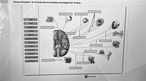 Solved Please Help Clinical Scenario The Cranial Nerves Anatomy And