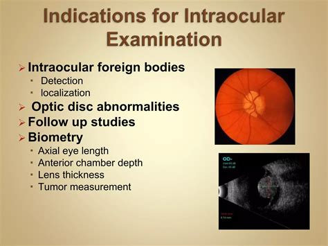 Ocular Ultrasound Ppt