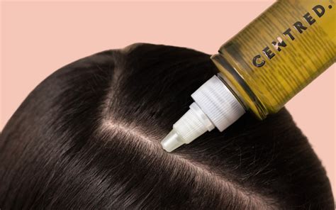 Dry Itchy Scalp? Here's How To Treat Your Scalp Right Away – CENTRED.®