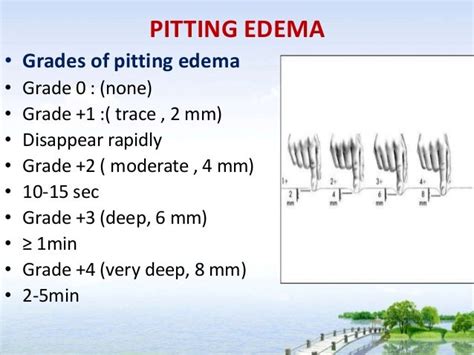 Ppt For Physical Examination