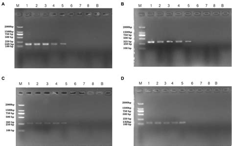 Frontiers Pseudomonas Aeruginosa Detection Using Conventional Pcr And Quantitative Real Time