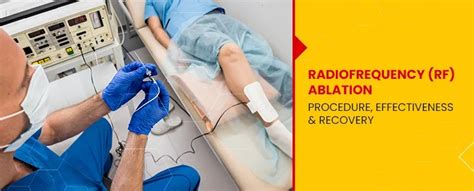 Radio frequency (RF) Ablation: Procedure, Effectiveness, and Recovery