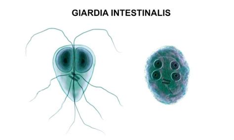 Qué es la infección por giardia