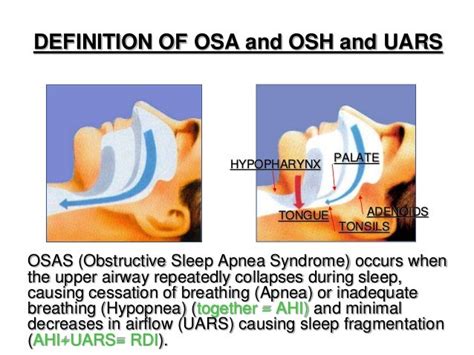 Obstructive Sleep Apnea Osa And Upper Airways Resistance Syndrome