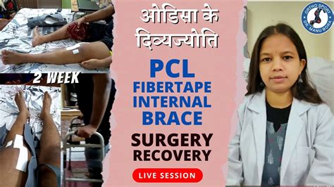 ओडस क दवयजयत PCL reconstruction rehab exercises at 2nd week