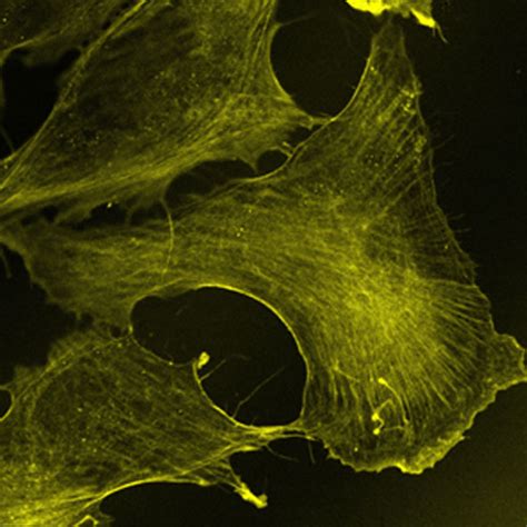 Expansion Microscopy Archives Chrometra