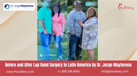 Lap Band Surgery In Latin America Top Clinics And Cost