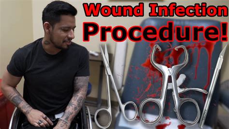 Emergency Procedure My Intense Visit To The Wound Specialist Youtube