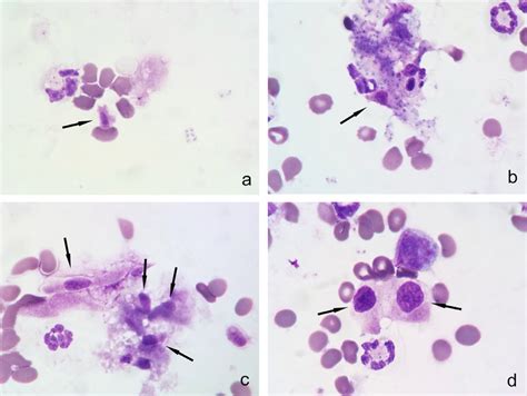 Microphotographs From A Case Of Pneumocystis Pneumonia Mgg Stain X 10 Download Scientific