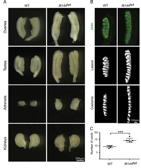 Figure 3 From Primary Cilia Function Regulates The Length Of The