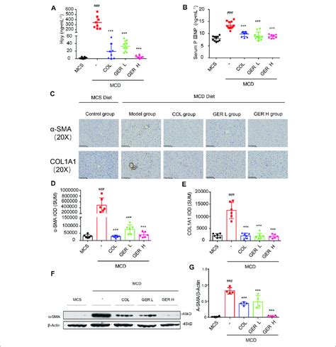 GER inhibits the activation of HSCs via TGF β Smad signaling pathway