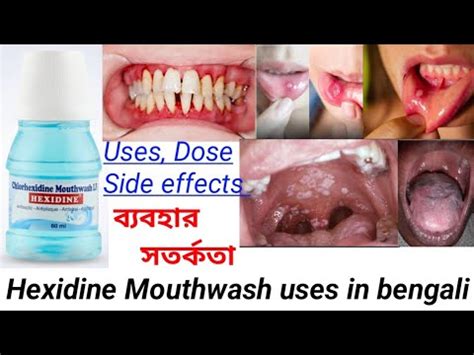 Hexidine Mouthwash Uses In Bengali How To Use Mouthwash YouTube