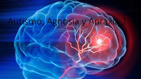 Autismo Agnosia Y Apraxia Youtube