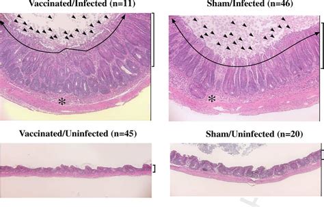 Table From Prevention Of Intestinal Amebiasis By Vaccination With The